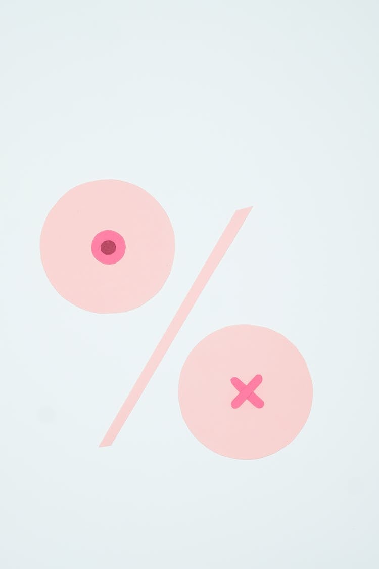 A Breast Cancer Illustration