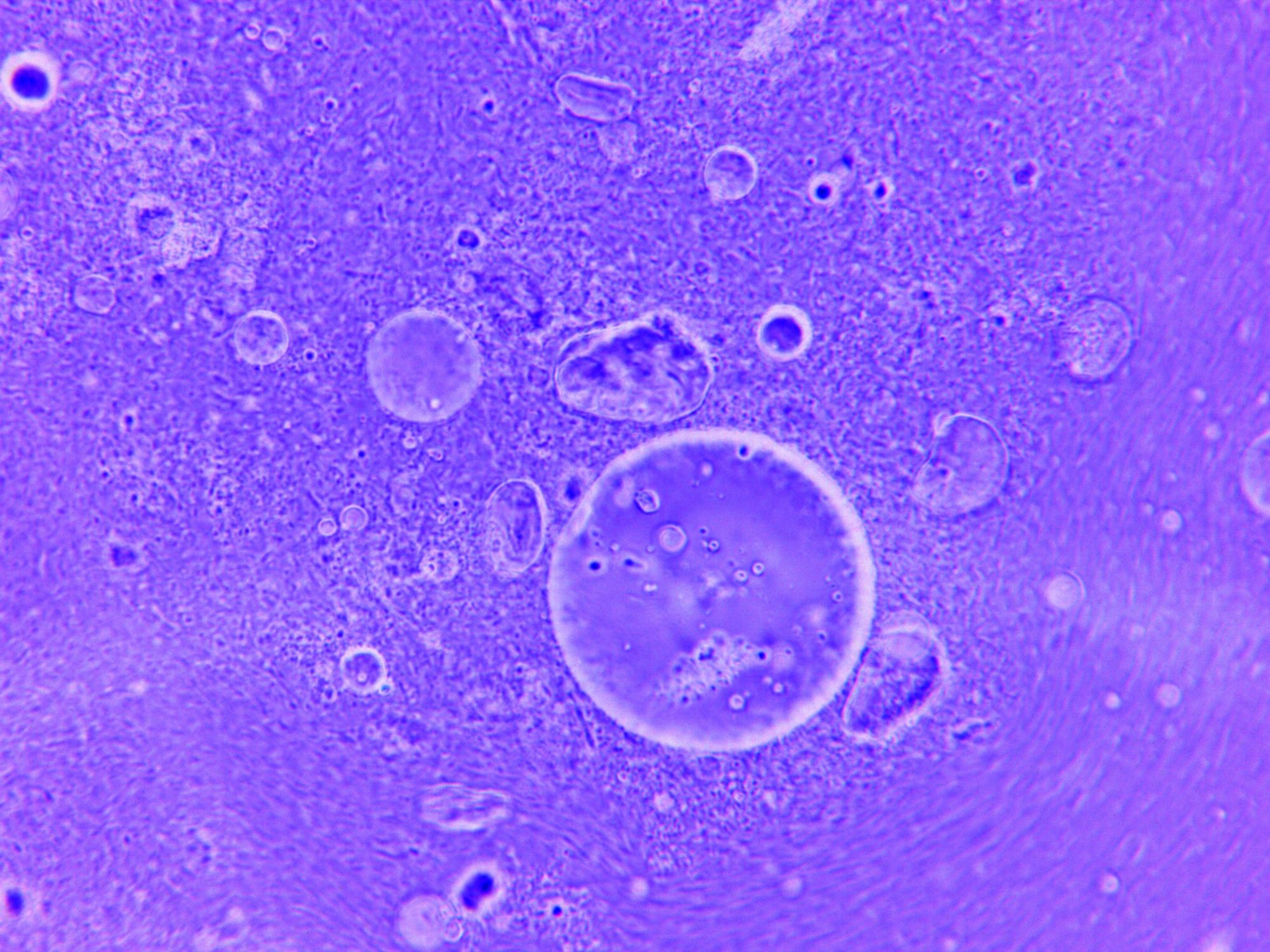 Imagen de microscopía de fluorescencia con células teñidas en tonos verdes y azules sobre fondo oscuro