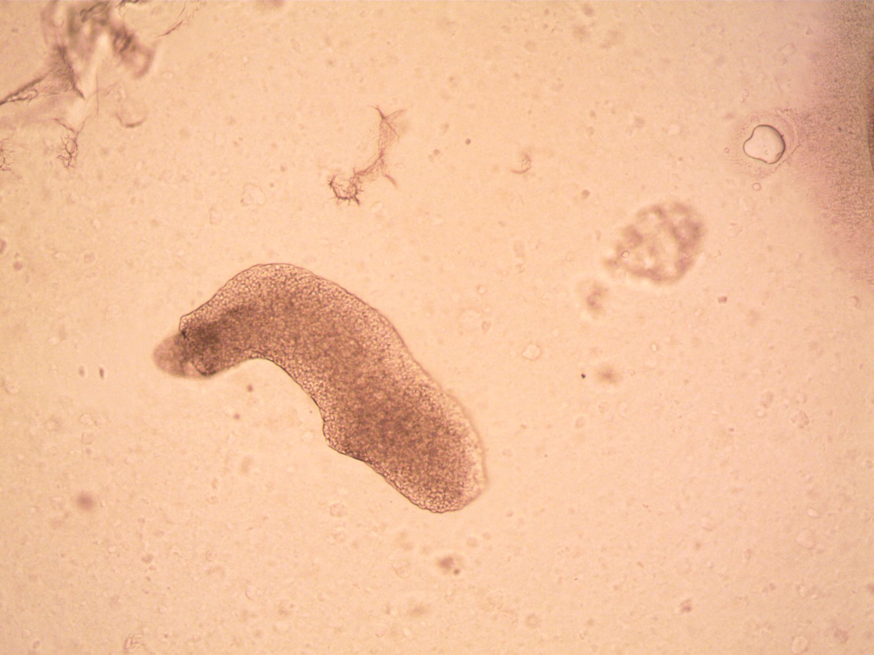 Onderzoek naar verspreiding vossenlintworm in Limburg