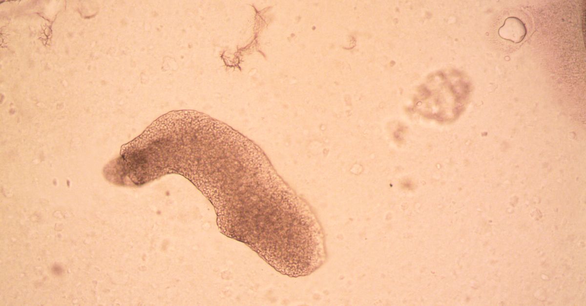 cholera