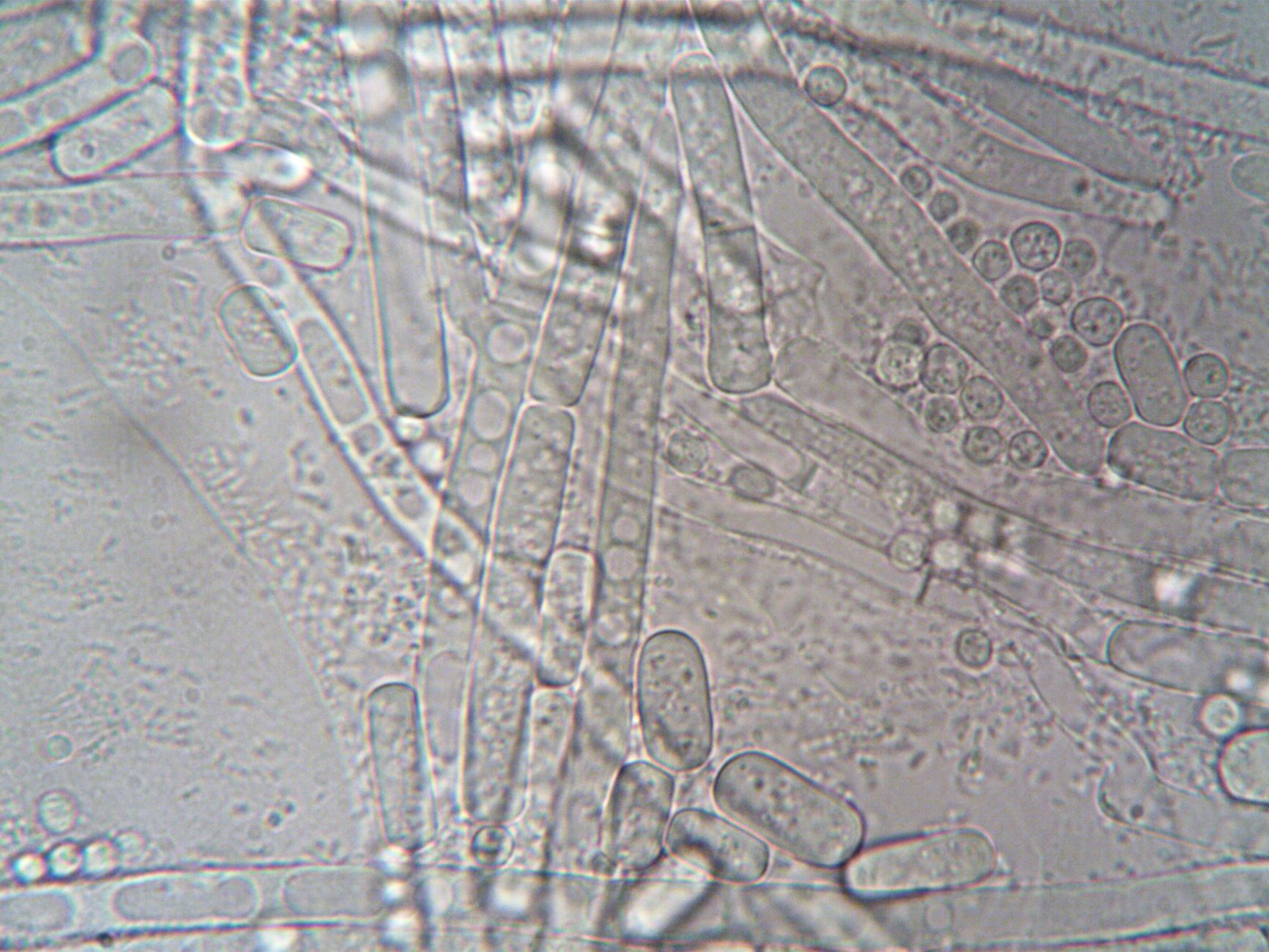 Close-up image of fungal hyphae under microscope showcasing biological structures.