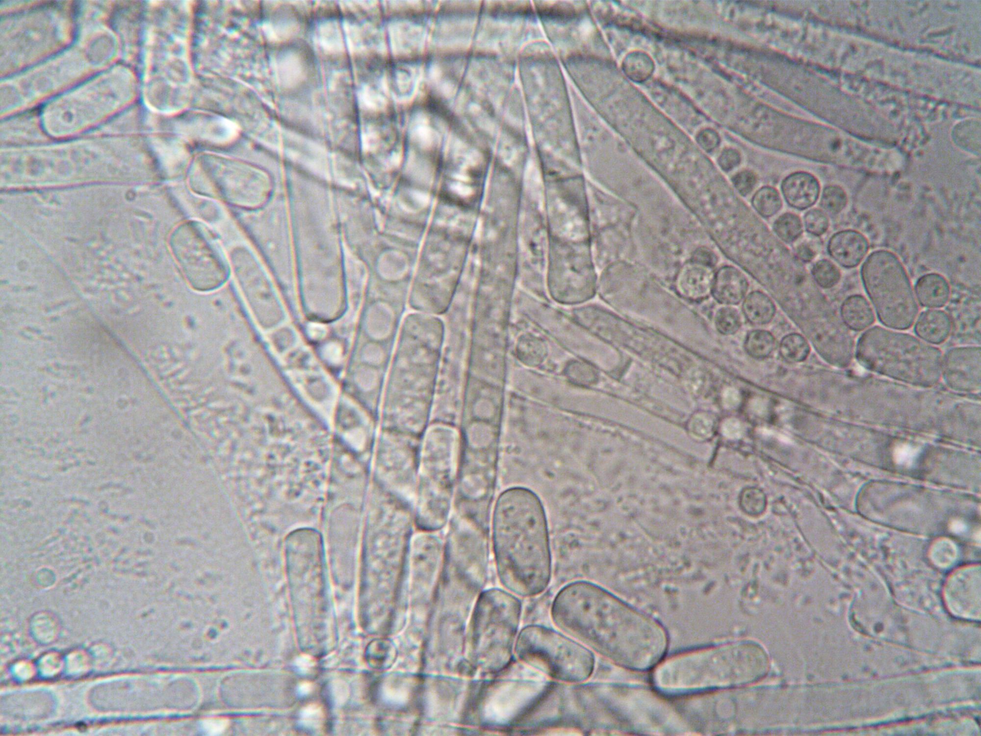 Close-up image of fungal hyphae under microscope showcasing biological structures.
