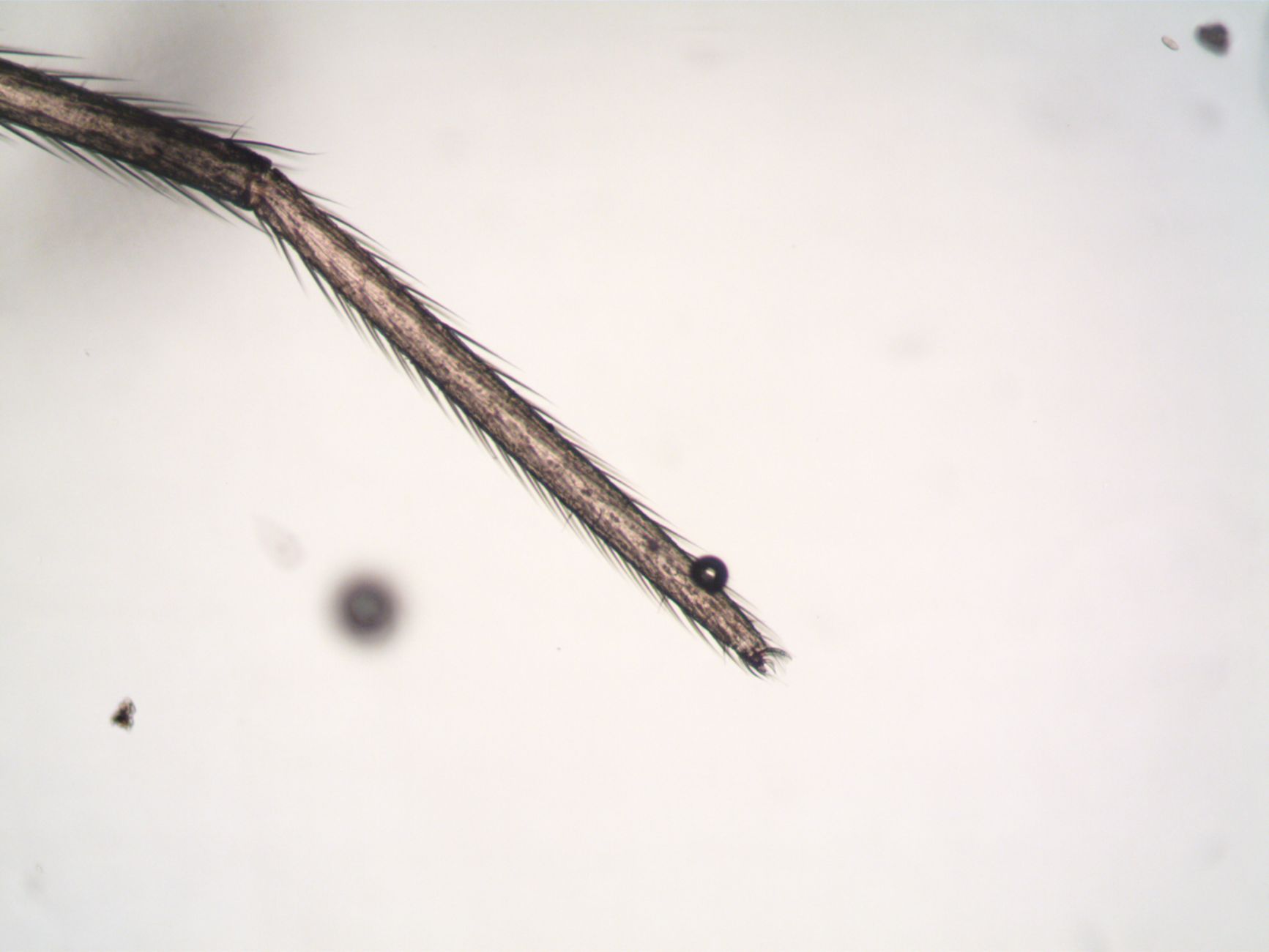 Detailed microscopic view of a spider leg, showcasing its intricate structure and bristles.