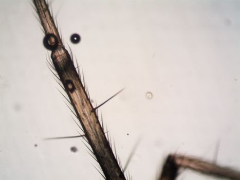 Detailed macro image showing spider's hairy leg structure under a microscope.