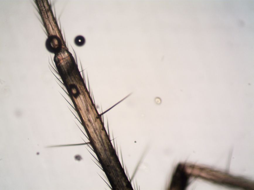 Detailed macro image showing spider's hairy leg structure under a microscope.