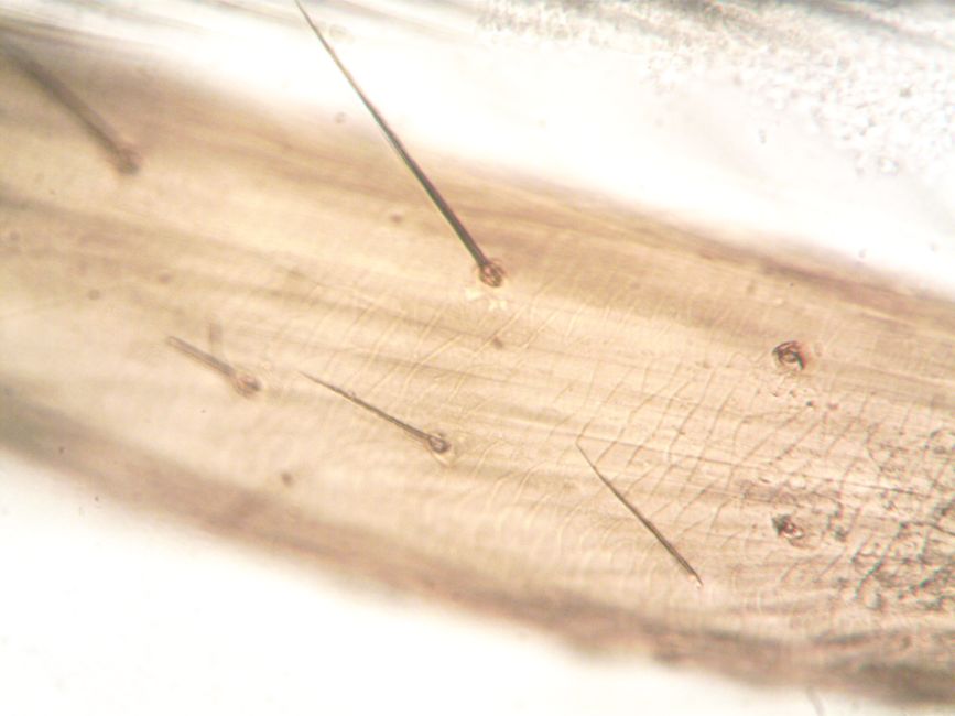 neuron cells brain tissue