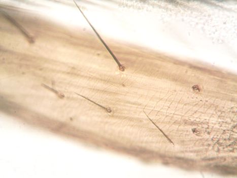 Extreme close-up of plant stem under microscope showing hair structures.