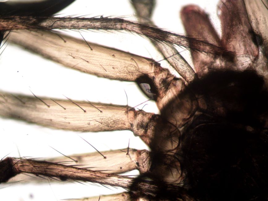 Fotomural Vista microscópica en primer plano de una araña que muestra la anatomía detallada y las estructuras del vello.