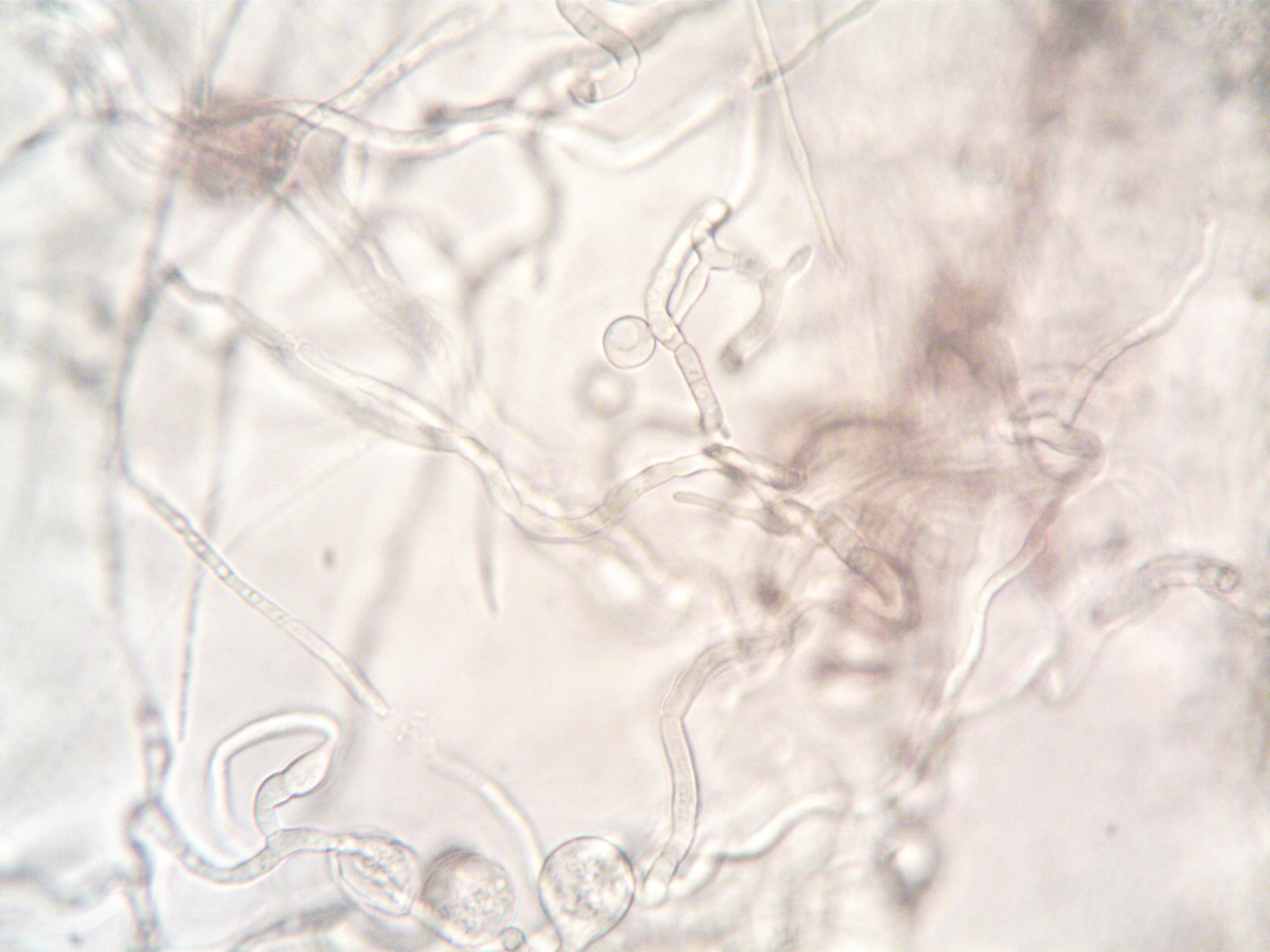 Microscopic view of bacteria and microorganisms