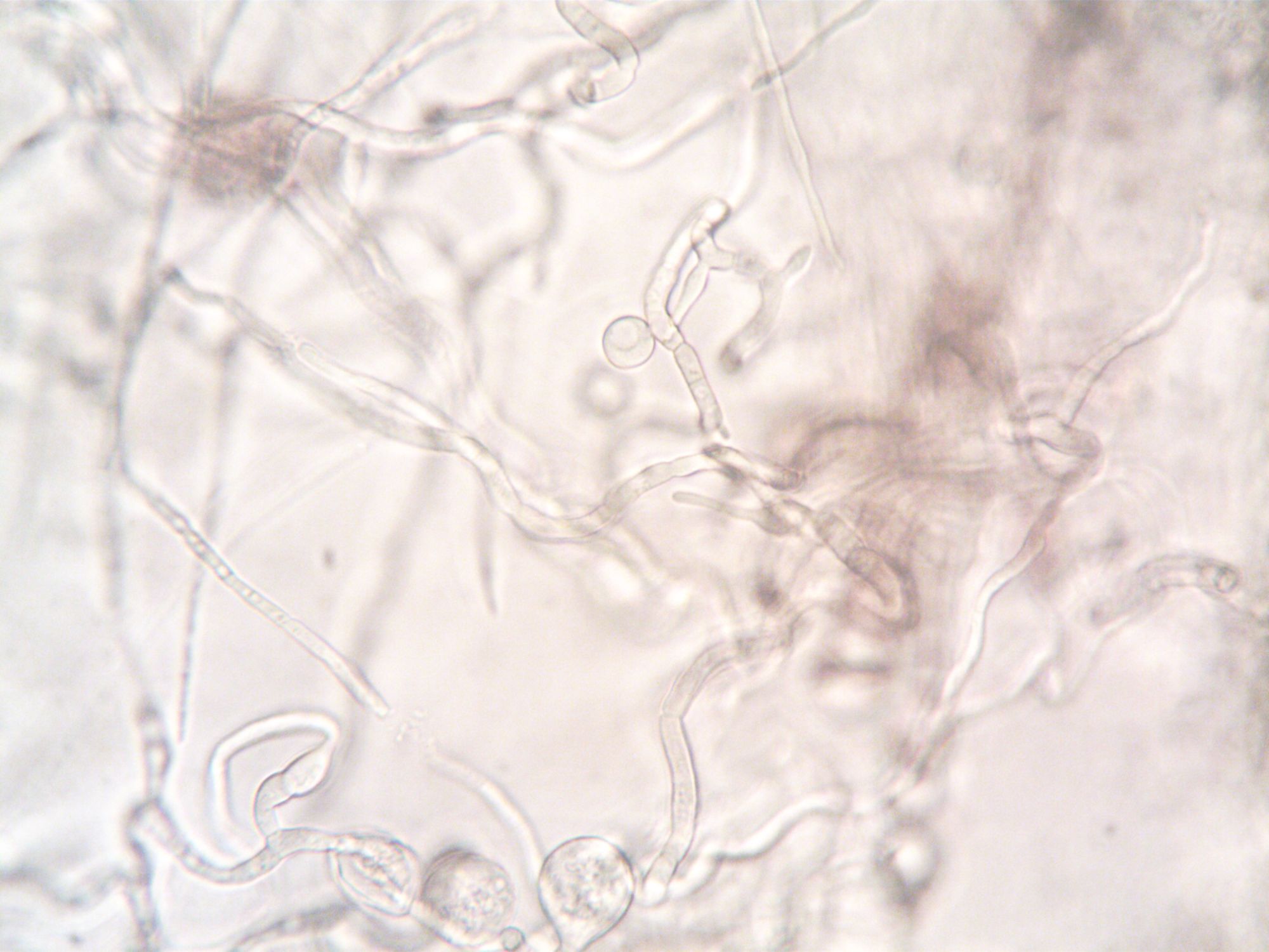 Close-up image depicting the detailed structure of fungal hyphae under a microscope.