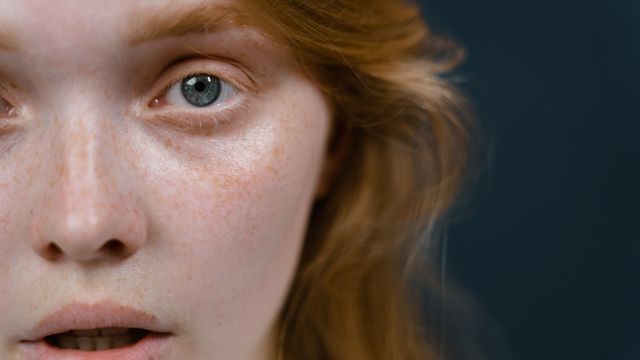 Rejuvenescimento Ocular em Jundiaí: A Blefaroplastia sem Cortes Vale a Pena? - Augusta Perfection