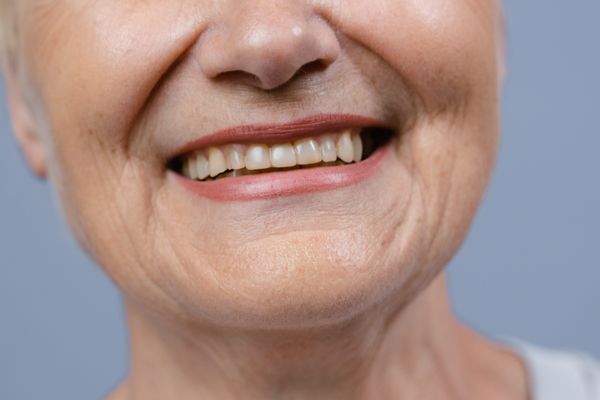 Prótesis dentales fijas y removibles en Madrid Sur