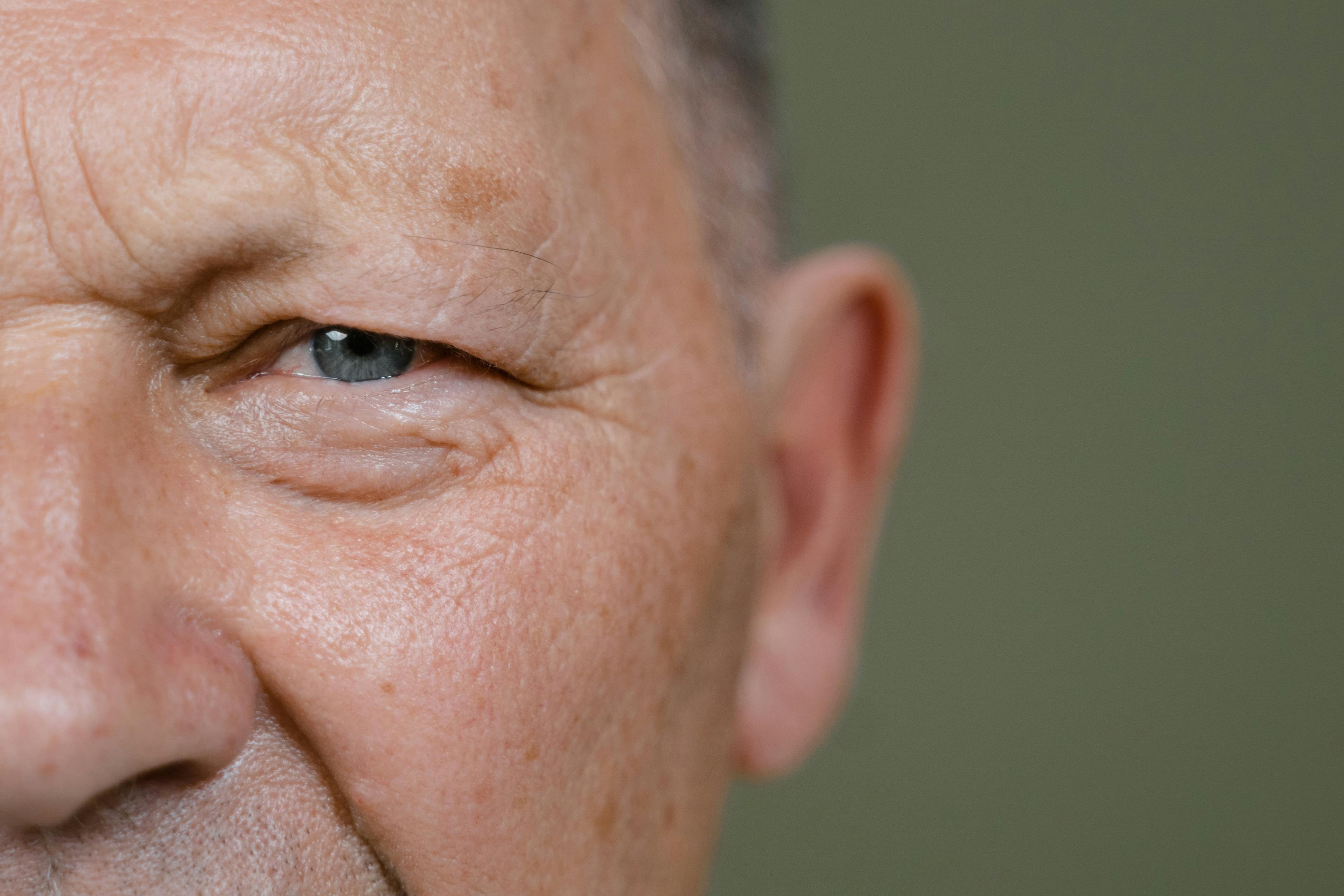 Toxins and Free Radicals Impact Your Complexion