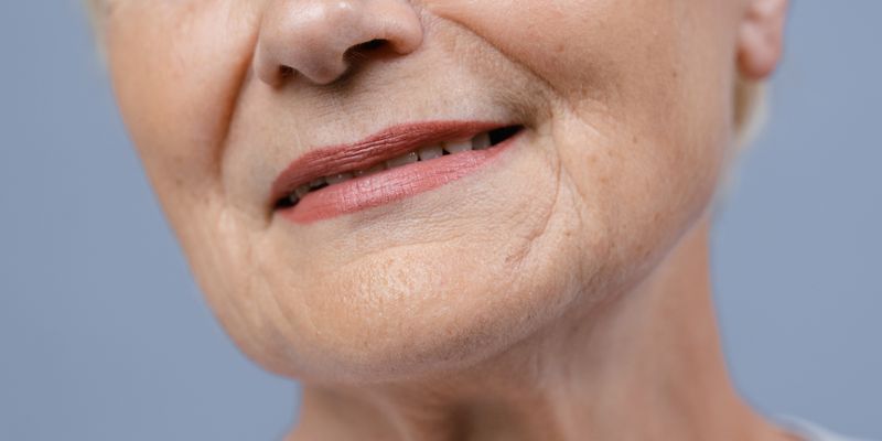 Rugas e sinais do envelhecimento facial