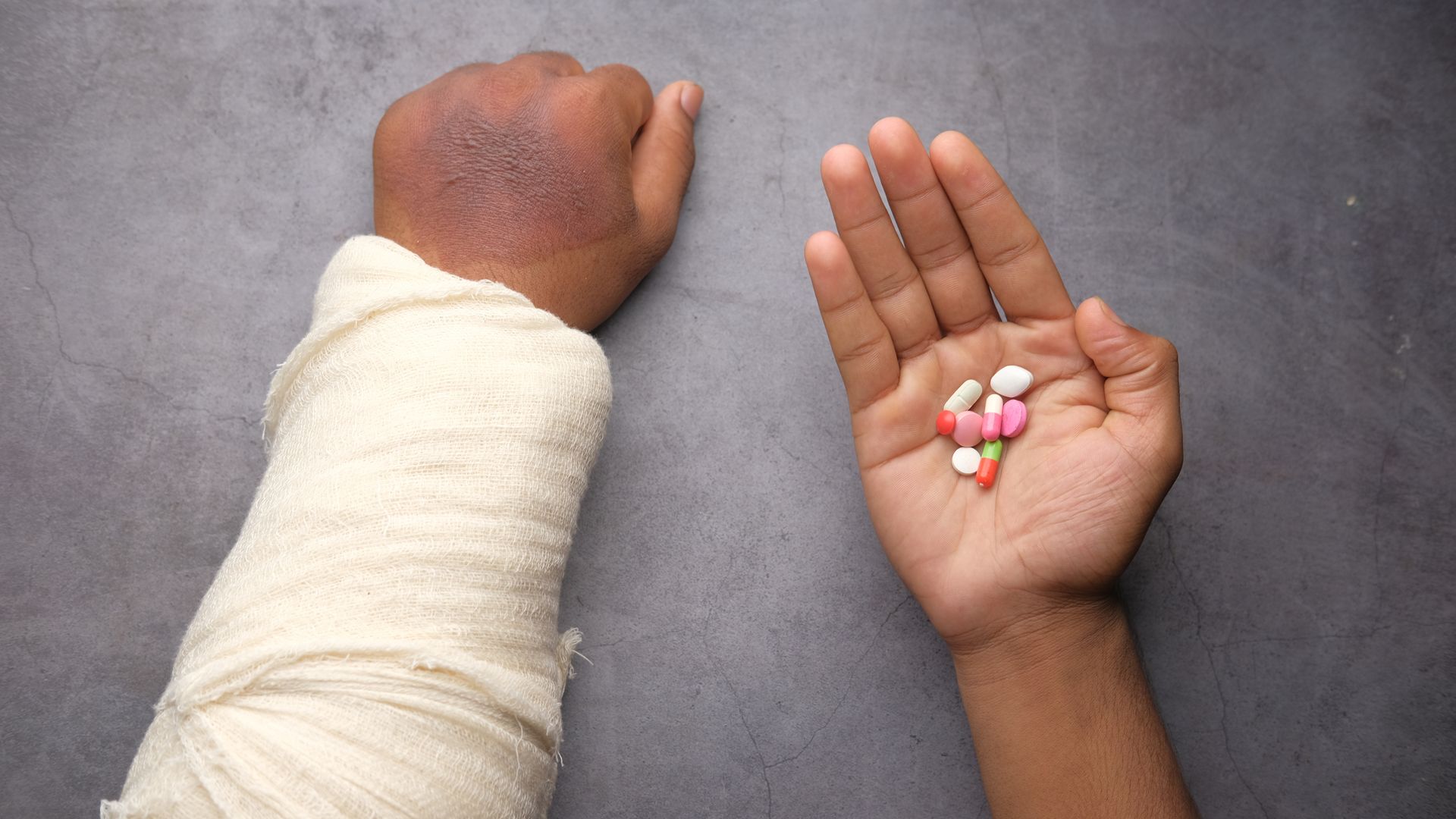 A close-up of an injured arm with a bandage and various pills on a gray background — modvigil 200 effects
