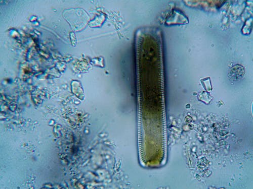 A Microorganism under a Microscope