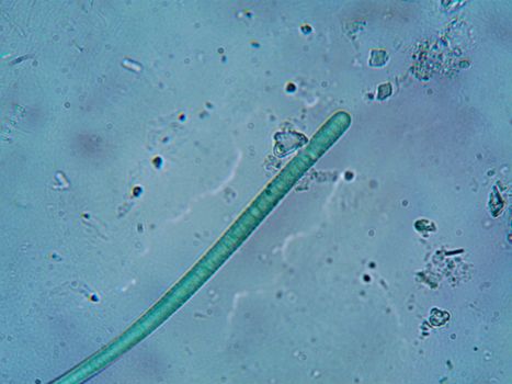 Bacteria Seen by Microscope 