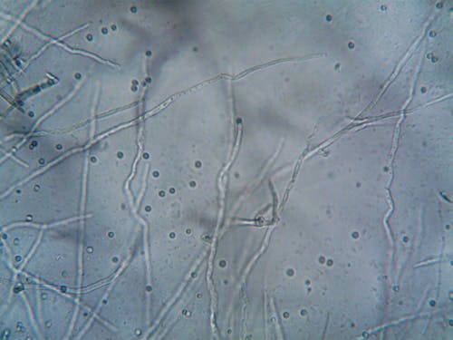 A Microorganism under a Microscope