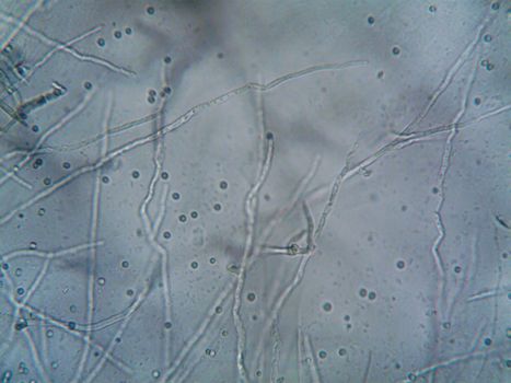 Close-up image of fungal hyphae and spores under a microscope, showcasing microbiological structures.