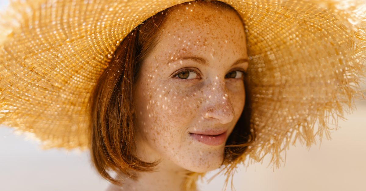 liver spots