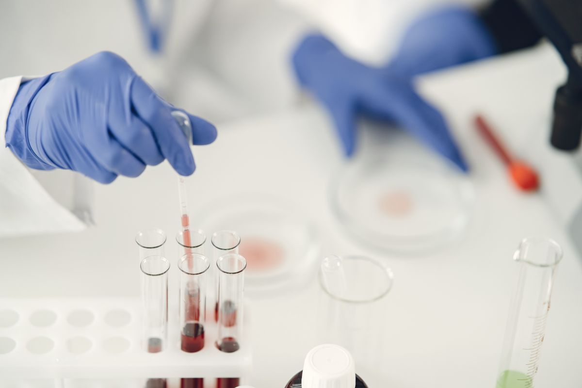 A person collecting a chemical sample using a dropper pipette