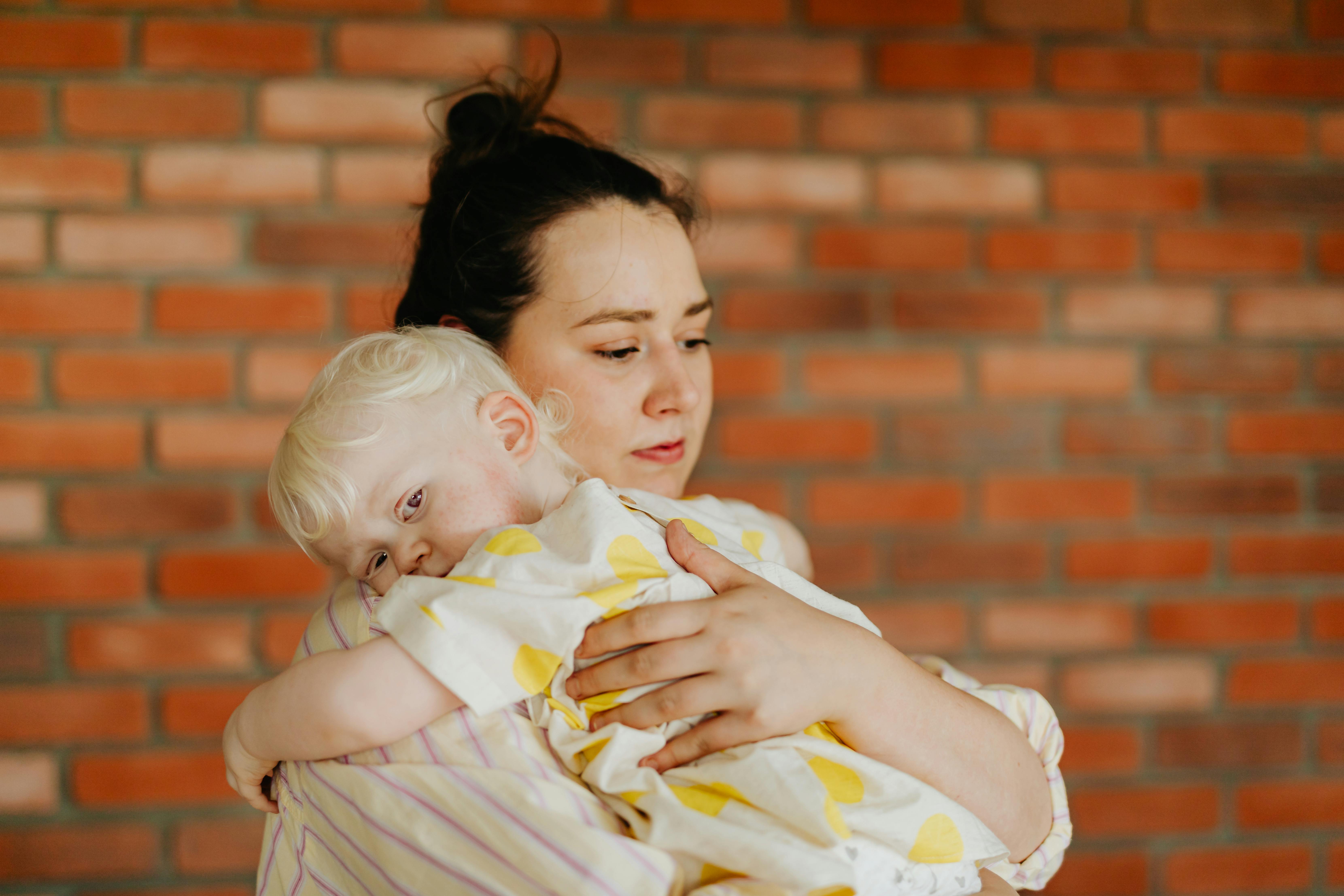 woman carrying albino baby