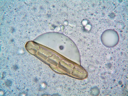Free Microorganism Under a Microscope Stock Photo