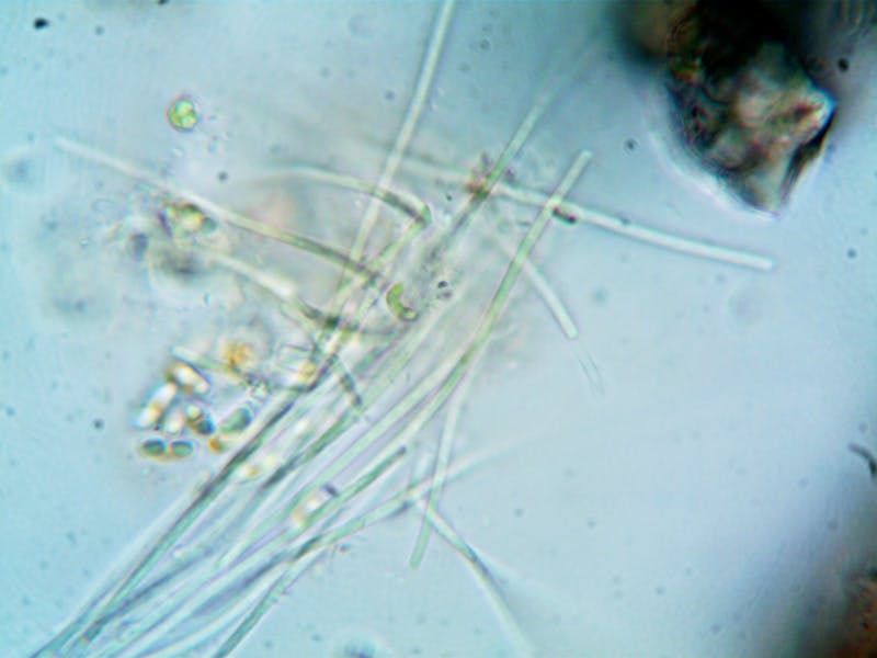 ibu memeluk anak perempuan dengan hangat