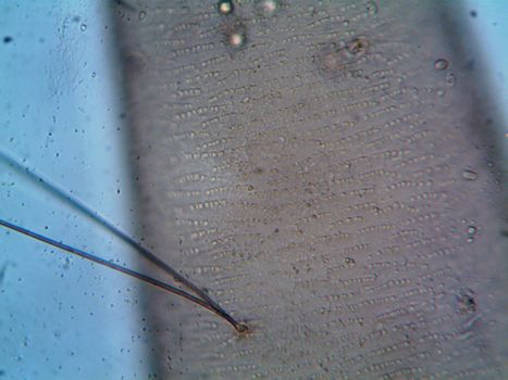Close-up image of hair follicle under a microscope, showing cellular structures.