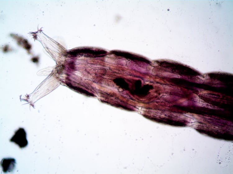 A Microscopic View Of A Microorganism