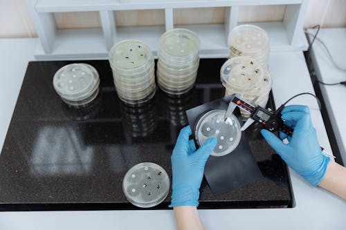 Laboratory Worker Holding a Petri Dish with Bacteria 