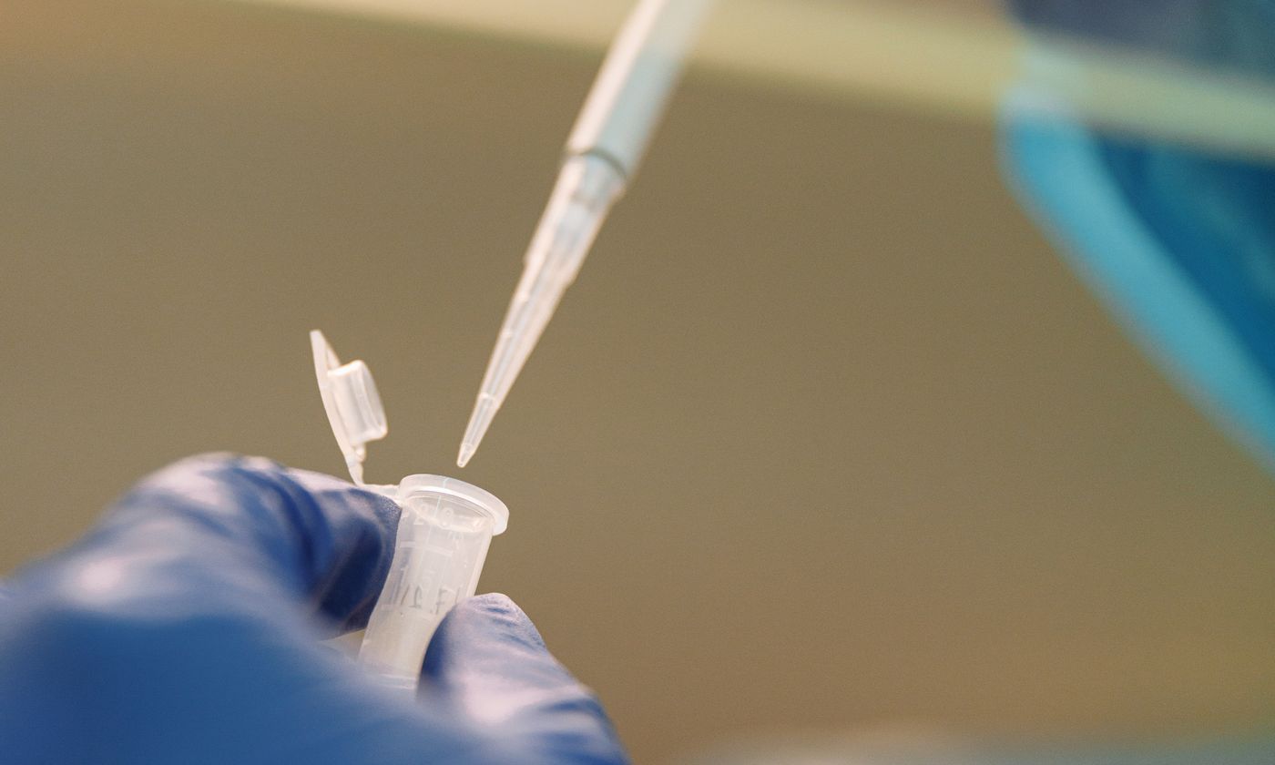 Laboratory liquid transfer using a dropper