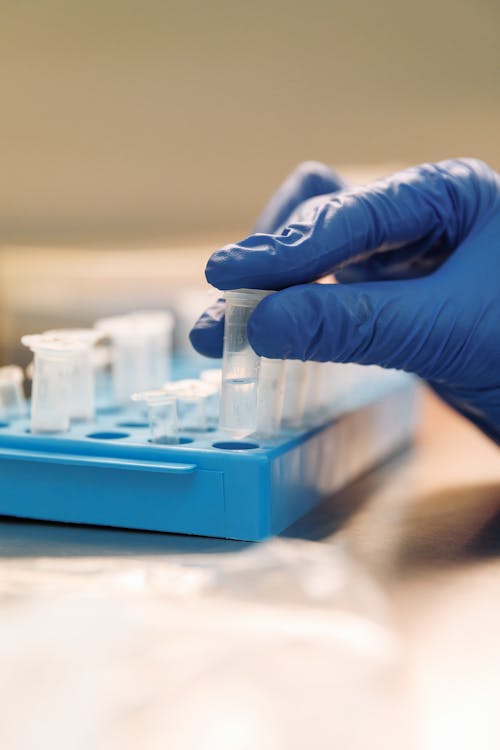 Close-Up Shot of Samples in a Test Tube Rack