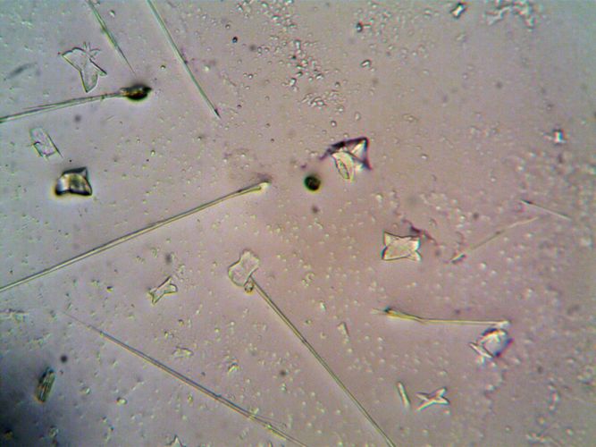 Microplastics Found in Earth's Deepest Ocean Trenches, Even Remote Areas