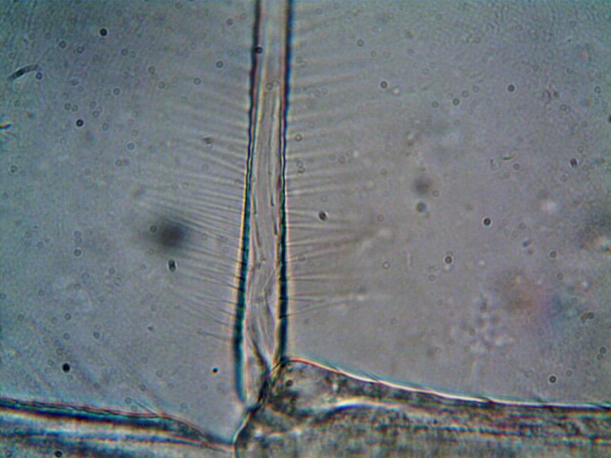 microscope view brain cells