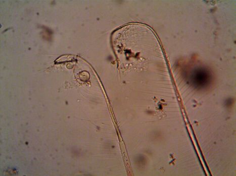 Close-up view of microorganisms under a microscope showcasing complex structures.