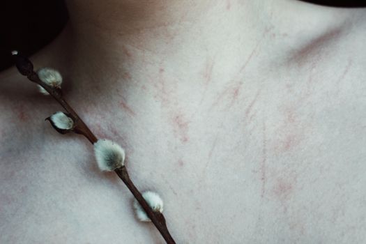 A detailed close-up of a pussy willow branch resting on textured human skin, creating a natural aesthetic.