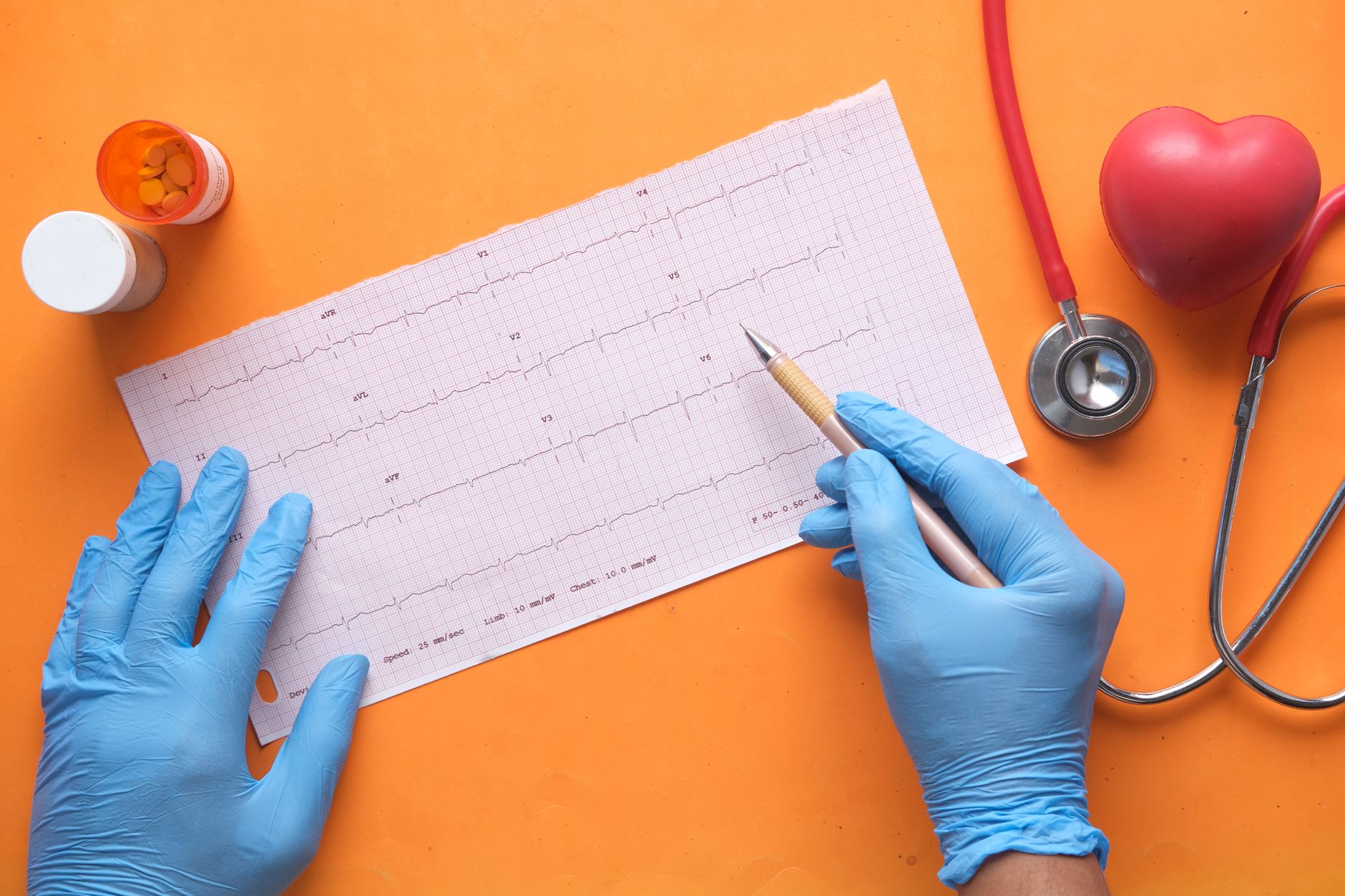 PRO-TAVI: Deferring PCI Before TAVI Non-Inferior to Routine PCI