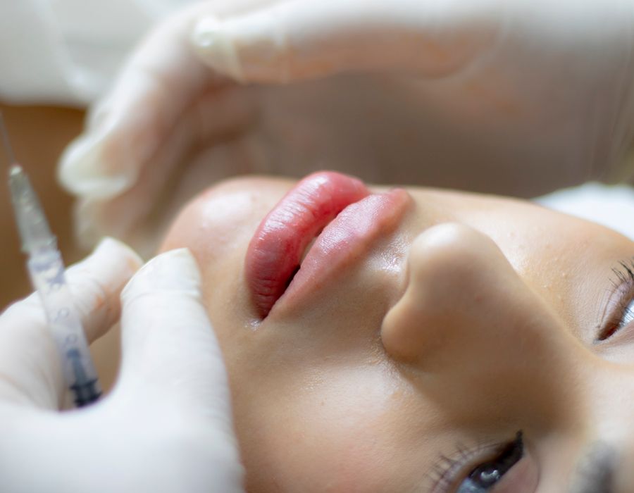 Lip augmentation procedure at Aesthetic Haus Med Spa