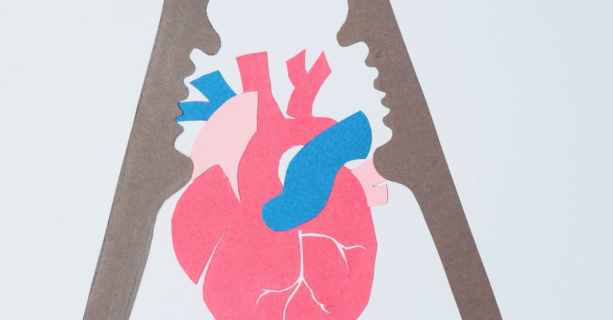 How long does heart attack pain last Reddit