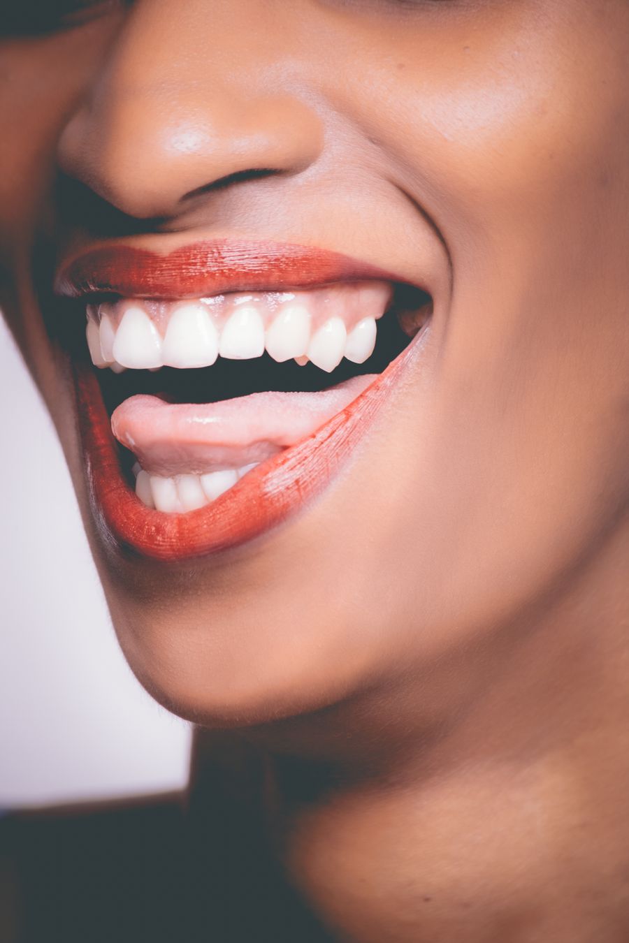 Bright, healthy white smile close-up