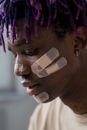 Side Profile of Man with Bandages on his Face