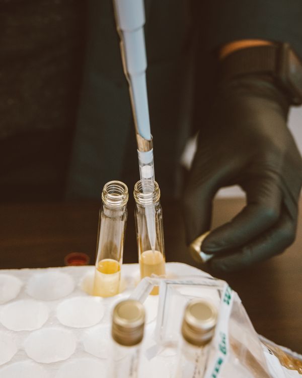 Free Close-up of a scientist using a pipette in laboratory, focusing on test tubes and black gloves for urine test. Stock Photo - Blog: Why a paediatric urine test (hereditarily transmitted diseases)