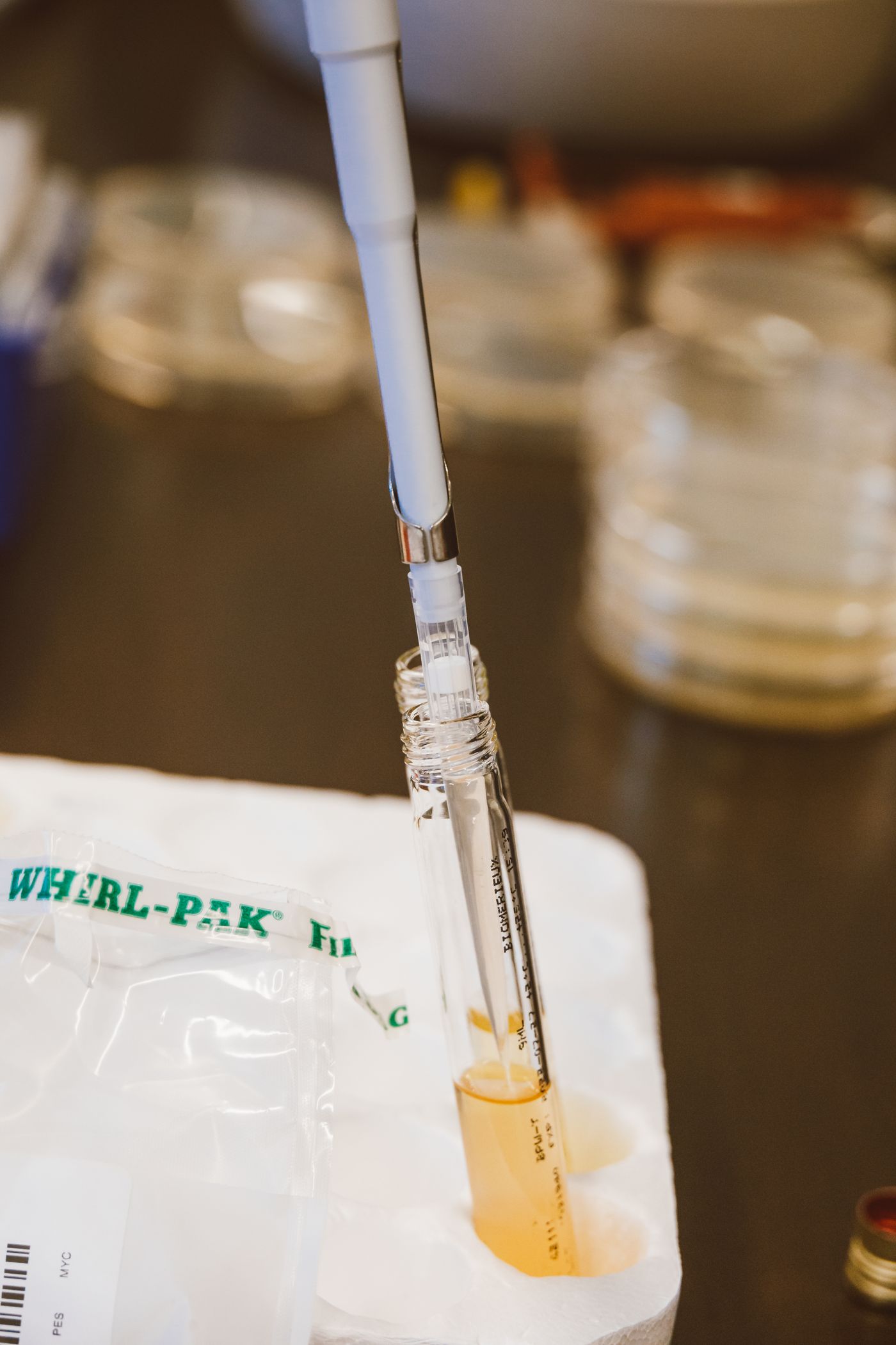 A laboratory pipette drawing a golden sample into a test vial