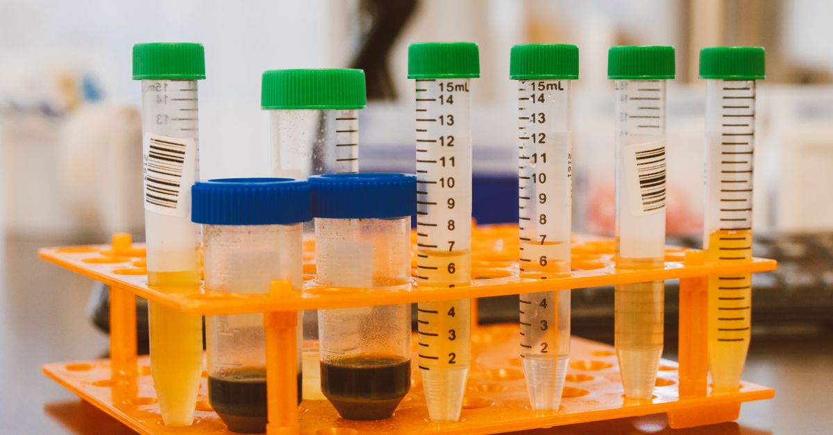 Dr. Robert Lentz Explores ctDNA in Tailored Colorectal Cancer Treatment