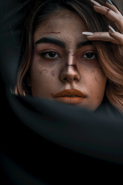 Free Woman with Bruises on Face Stock Photo