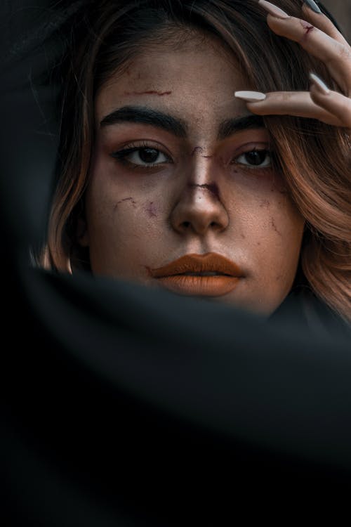 Free Woman with Bruises on Face Stock Photo