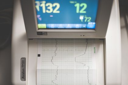 Ruling Out Heart Attacks Faster: The PRESC1SE-MI Study's ED Impact
