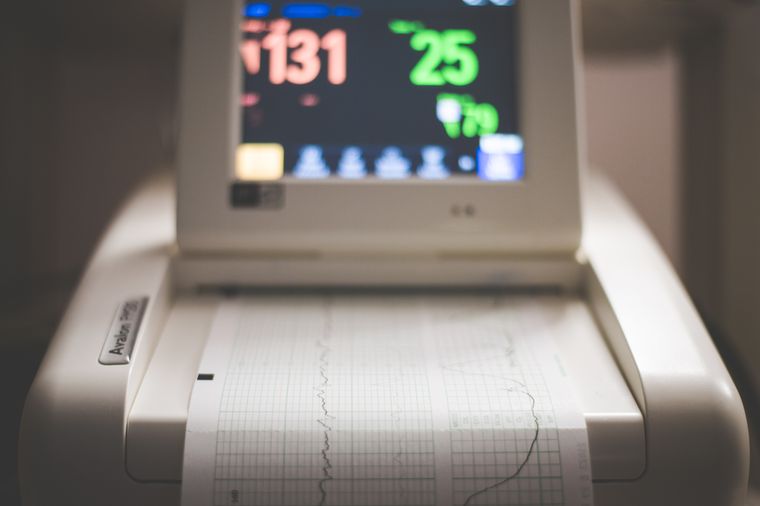 Detailed image of an electronic fetal monitoring machine showing heart rate and contraction data.
