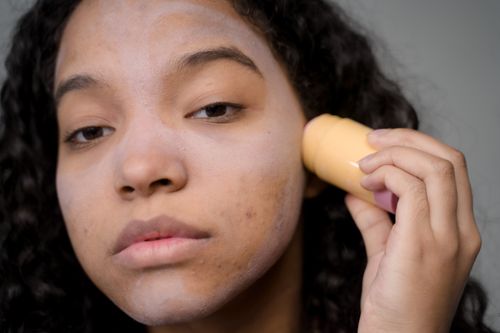 Free Close-up portrait of a woman applying skincare product to address acne and improve skin texture. Stock Photo